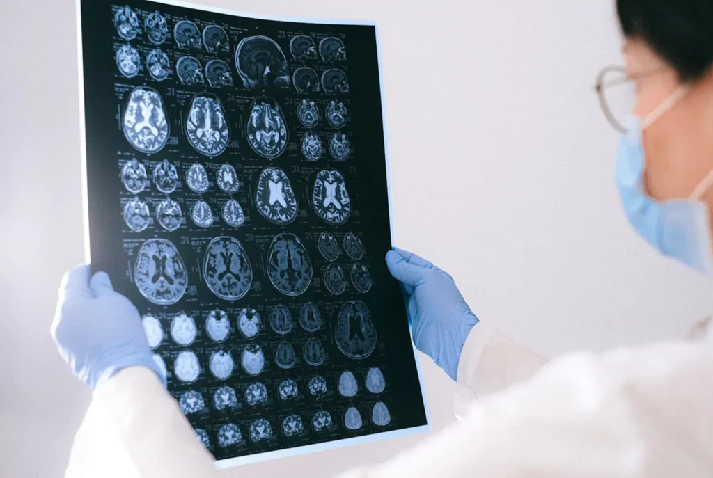 Diagnose von Hirnkrankheiten